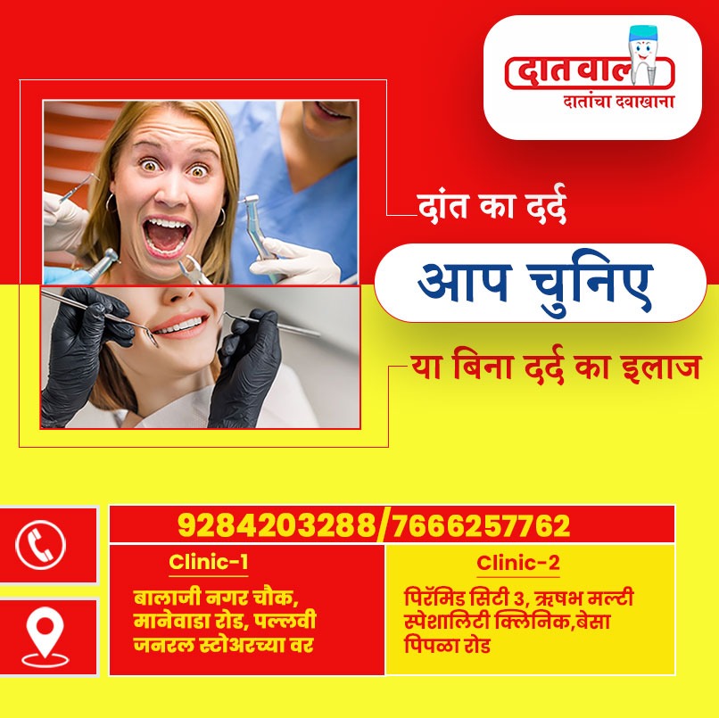 Dental Implants